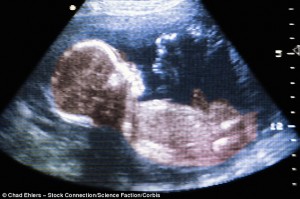 New Study: Autism Linked to Environment