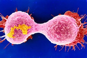 Sin azúcar las células cancerosas mueren